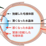 近視の原因は？老眼の原因は？近視と遠視の違いは？